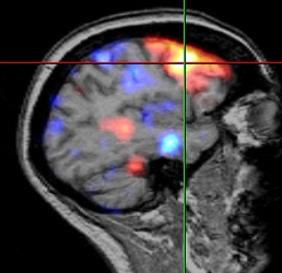 SISCOM_AMDCropped_TEL_AnalyzeDirectStaff